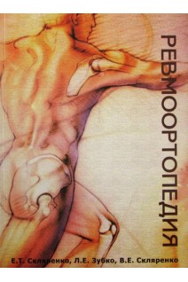 Ревмоортопедия. Скляренко Е.Т