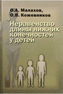Неравенство длины нижних конечностей у детей. Малахов О.А. Кожевников О.В.