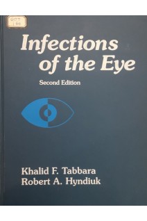 Infections of the Eye. Khalid F. Tabbara Robert A. Hyndiuk