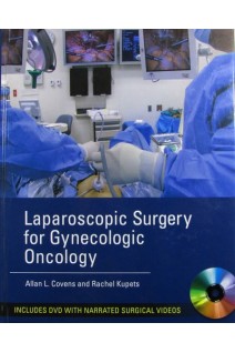 Laparoscopic Surgery for Gynecologic Oncology. Allan Covens and Rachel Kupets