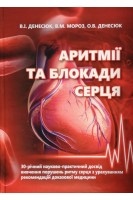 Аритмії та блокади серця: 30-річний науково-практичний досвід вивчення порушень ритму серця з урахуванням рекомендацій доказової медицини. Денесюк В.І. Мороз В.М. Денесюк О.В.