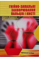 Гнійно-запальні захворювання пальців і кисті. Зубаха А.Б. Лігоненко О.В. Чорна І.О.