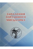Запалення гортанного мигдалика. Лайко А.А. Заболотний Д.І. Ткаліна А.В. та інші