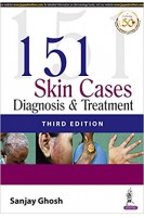 151 Skin Cases: Diagnosis & Treatment. Sanjay Ghosh