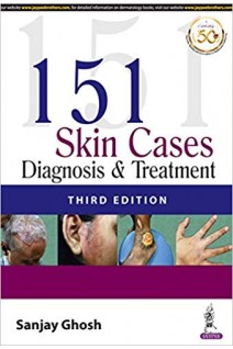 151 Skin Cases: Diagnosis & Treatment. Sanjay Ghosh