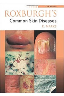 Roxburgh's Common Skin Diseases 17Ed. Ronald Marks