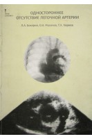 Одностороннее отсутствие легочной артерии. Бокерия Л.А.
