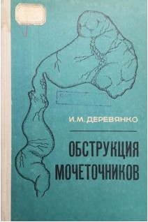 Обструкция мочеточников (БУ). Деревянко И.М.