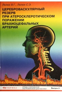 Цереброваскулярный резерв при атеросклеротическом поражении брахиоцефальных артерий. Этюды современной ультразвуковой диагностики. Лелюк В.Г. Лелюк С.Э.