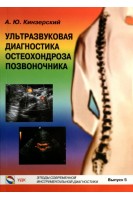 Ультразвуковая диагностика остеохондроза позвоночника. Этюды современной ультразвуковой диагностики. Кинзерский А.Ю.