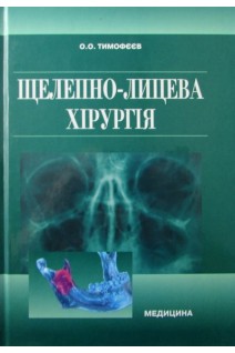 Щелепно-лицева хірургія. Підручник. 3-е видання. Тимофєєв О.О.