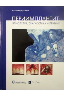 Периимплантит: Этиология диагностика и лечение. Франк Шварц Юрген Бекер