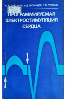 Программируемая электростимуляция сердца (БУ). Бредикис Ю.Ю.