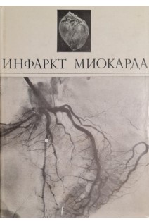 Инфаркт миокарда (БУ). Виноградов А.В.