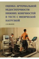 Оценка артериальной недостаточности нижних конечностей в тесте с физической нагрузкой. Иванов С.В.