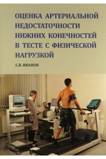 Оценка артериальной недостаточности нижних конечностей в тесте с физической нагрузкой. Иванов С.В.