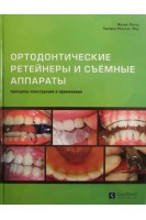 Ортодонтические ретейнеры и съёмные аппараты. Лютер Фриди. Зарарна Нельсон-Мун