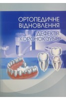 Ортопедичне відновлення дефектів коронок зубів. Макєєв В.Ф.