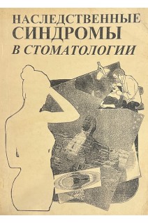 Наследственные синдромы в стоматологии (БУ). Волкова А.С.