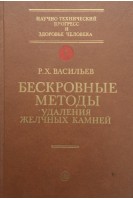 Бескровные методы удаления желчных камней (БУ). Васильев Р.Х.