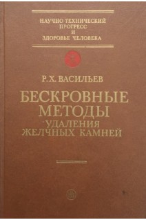 Бескровные методы удаления желчных камней (БУ). Васильев Р.Х.