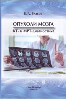Опухоли мозга. КТ- и МРТ- диагностика. Власов Е.А.