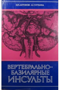 Вертебрально-базилярные инсульты (БУ). Антонов И.