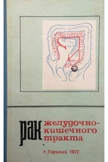 Рак желудочно-кишечного тракта (Труды. Выпуск 42) (БУ). Матюшин И.Ф.