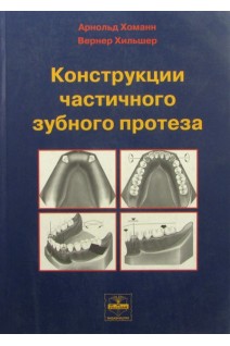 Конструкции частичного зубного протеза. Хоманн А. Хильшер В.