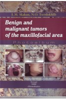 Benign and malignant tumors of the maxillofacial area (Доброякісні та злоякісні пухлини щелепно-лицевої ділянки (фотоальбом)). Skakun LM. (Скакун Л.М.)