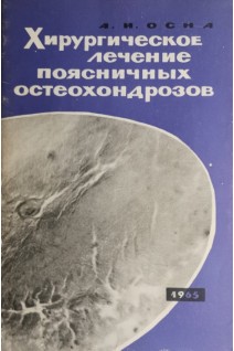 Хирургическое лечение поясничных остеохондрозов (БУ). Осна А.И.