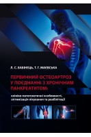 Первинний остеоартроз у поєднанні з хронічним панкреатитом. Бабінець Л.С.