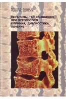 Переломы тел позвонков при остеопорозе. Клиника диагностика лечение. Ветрилэ С.Т. Кулешов А.А. Морозов А.К. и др.