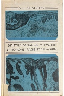Эпителиальные опухоли и пороки развития кожи (БУ). Атапенко А.К.