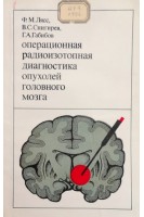 Операционная радиоизотопная диагностика опухолей головного мозга (БУ). Лясс Ф.М.