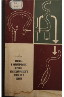 Клиника и хирургическое лечение неспецифического язвенного колита (БУ). Васильев А.А.