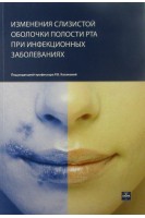 Изменения слизистой оболочки полости рта при инфекционных заболевания.. Казакова Р.В. Нейко Н.В.