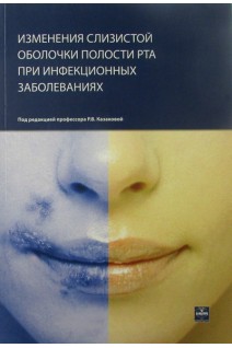 Изменения слизистой оболочки полости рта при инфекционных заболевания.. Казакова Р.В. Нейко Н.В.