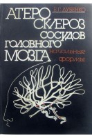 Атеросклероз сосудов головного мозга (начальные формы) (БУ). Дубенко Е.Г.