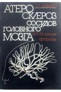 Атеросклероз сосудов головного мозга (начальные формы) (БУ). Дубенко Е.Г.