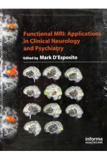 Functional MRI: Applications in Clinical Neurology and Psychiatry. Mark D’Esposito