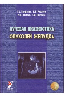 Лучевая диагностика опухолей желудка. Труфанов Г.Е.