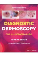Diagnostic Dermoscopy: The Illustrated Guide. Jonathan Bowling