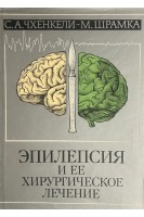 Эпилепсия и ее хирургическое лечение. Чхенкели С.А.