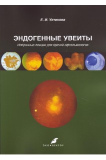 Эндогенные увеиты. Избранные лекции для врачей-офтальмологов. Устинова Е.И.