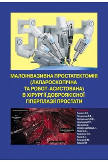 Малоінвазивна простатектомія (лапароскопічна та робот-асистована) в хірургії доброякісної гіперплазії простати: навчальний посібник . Горовий В.І. Петрушенко В.В. Шапринський В.О. та ін.