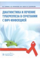 Диагностика и лечение туберкулеза в сочетании с ВИЧ-инфекцией . Зимина В.Н. Кравченко А.В. Зюзя Ю.Р. Васильева И.А.