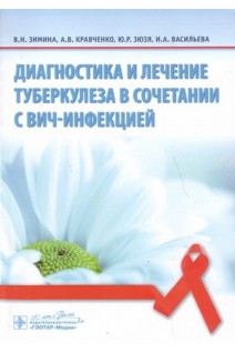 Диагностика и лечение туберкулеза в сочетании с ВИЧ-инфекцией . Зимина В.Н. Кравченко А.В. Зюзя Ю.Р. Васильева И.А.