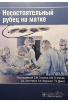 Несостоятельный рубец на матке. под ред. Е.Ю. Глухова С.Н. Буяновой Л.С. Логутовой