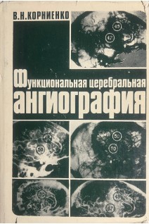Функциональная церебральная ангиография (БУ). Корниенко В.Н.